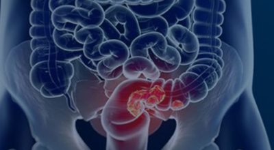 © Câmara Municipal de Afonso Claudio/Divulgação